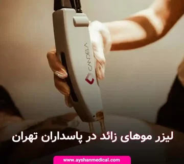 مرکز تخصصی لیزر موهای زائد در پاسداران تهران | آیشن